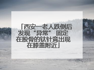西安一老人跌倒后发现“异常” 固定在股骨的钛针竟出现在膝盖附近